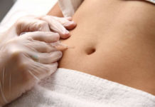 Carboxiterapia: el tratamiento perfecto para rejuvenecer y adelgazar carboxiterapia