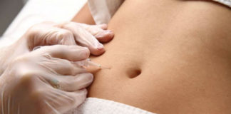 Carboxiterapia: el tratamiento perfecto para rejuvenecer y adelgazar carboxiterapia