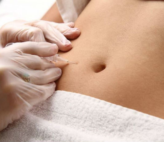 Carboxiterapia: el tratamiento perfecto para rejuvenecer y adelgazar carboxiterapia