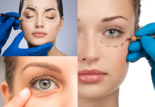 ¿Cuál es el precio de una blefaroplastia? Blefaroplastia precio