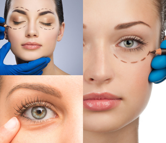 ¿Cuál es el precio de una blefaroplastia? Blefaroplastia precio