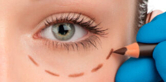 ¿Cuál es el mejor cirujano de blefaroplastia de Valencia? blefaroplastia en Valencia